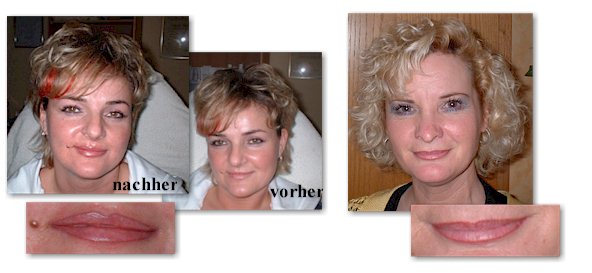 Permanent Make up Lippenverbreiterung